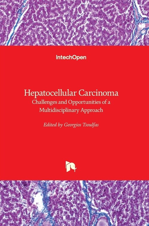 Hepatocellular Carcinoma : Challenges and Opportunities of a Multidisciplinary Approach (Hardcover)