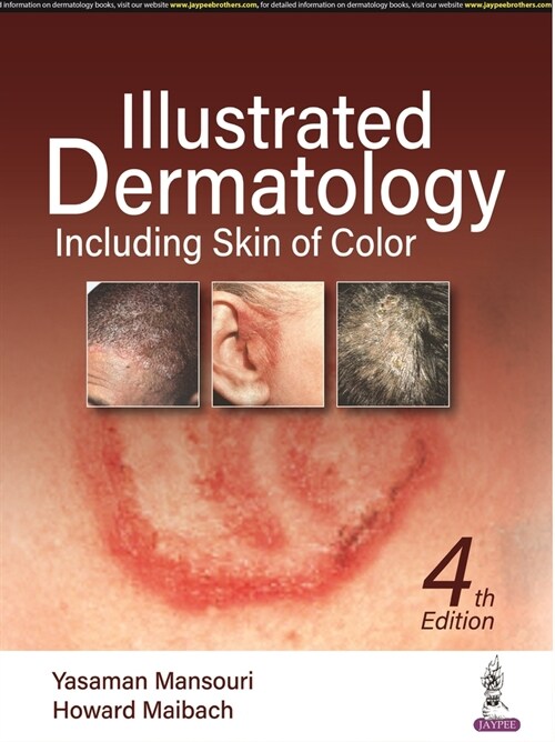 Illustrated Dermatology : Including Skin of Colour (Hardcover, 4 Revised edition)