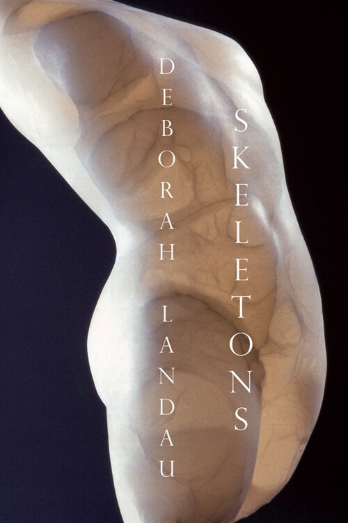 Skeletons (Paperback)