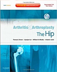 Arthritis and Arthroplasty: The Hip : Expert Consult - Online, Print and DVD (Hardcover)