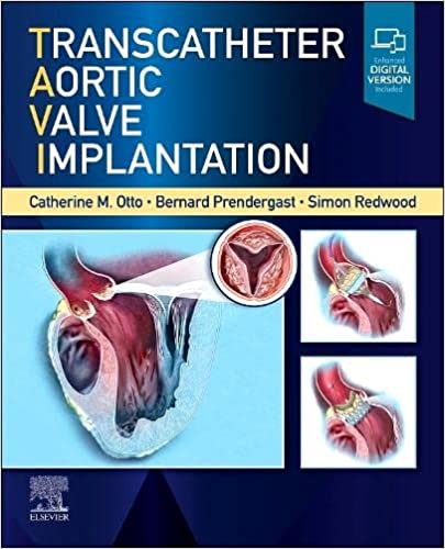 Transcatheter Aortic Valve Implantation (Hardcover)