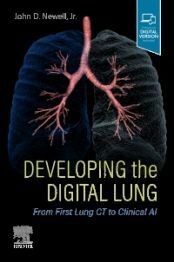 Developing the Digital Lung: From First Lung CT to Clinical AI (Paperback)