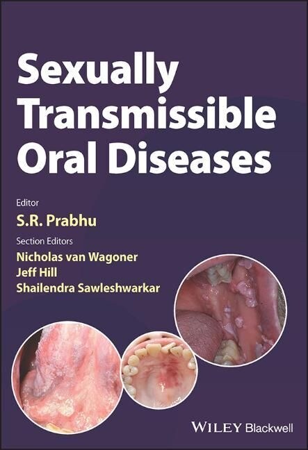 Sexually Transmissible Oral Diseases (Paperback)