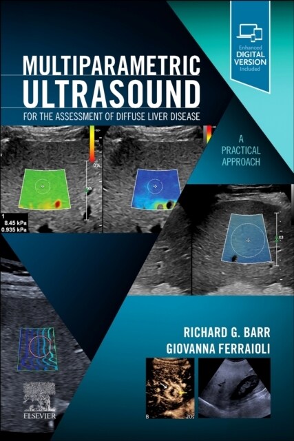 Multiparametric Ultrasound for the Assessment of Diffuse Liver Disease: A Practical Approach (Paperback)