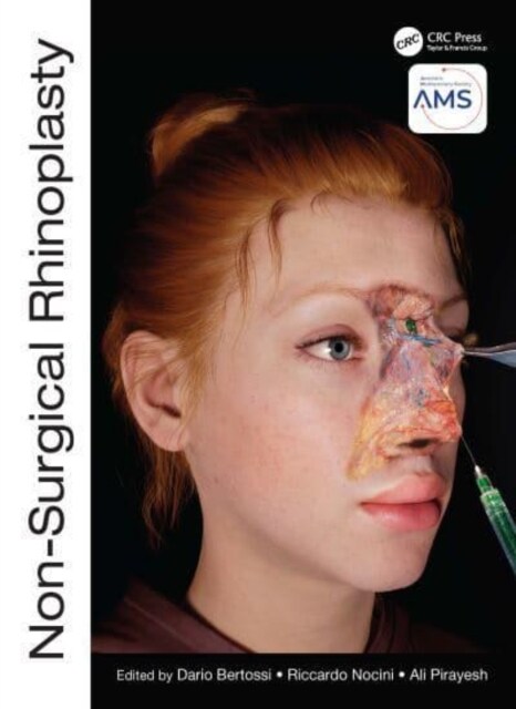 Non-Surgical Rhinoplasty (Hardcover, 1)