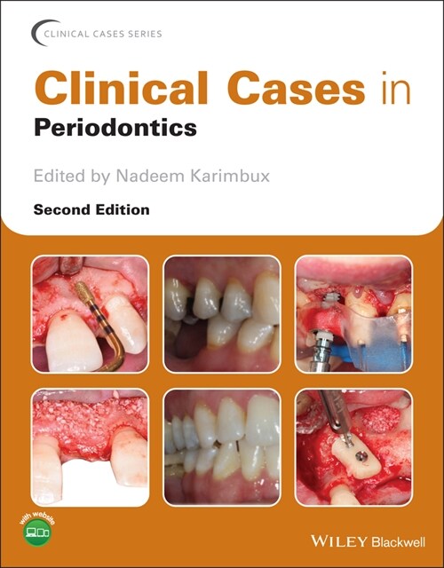 [eBook Code] Clinical Cases in Periodontics (eBook Code, 2nd)