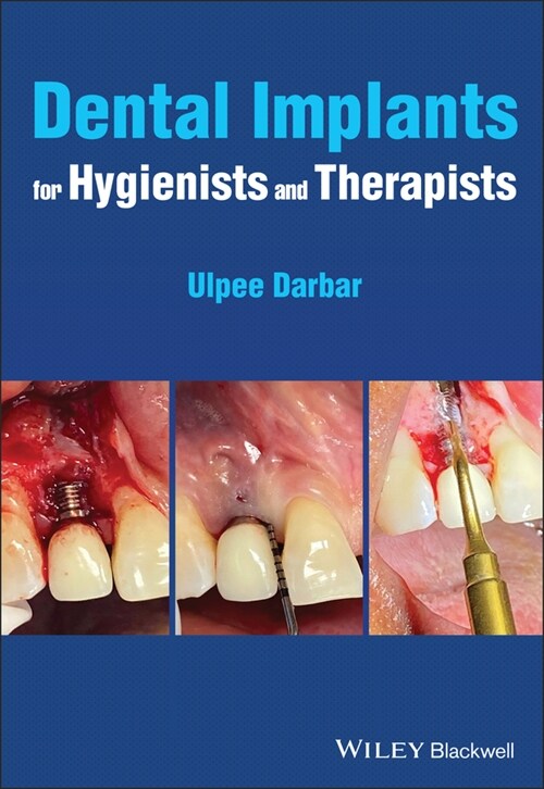 [eBook Code] Dental Implants for Hygienists and Therapists (eBook Code, 1st)