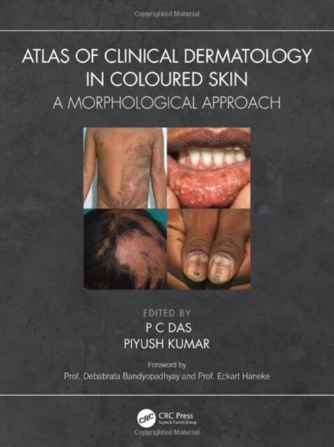 Atlas of Clinical Dermatology in Coloured Skin : A Morphological Approach (Hardcover)