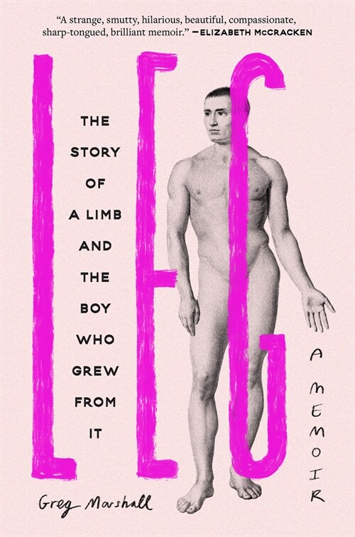 Leg: The Story of a Limb and the Boy Who Grew from It (Hardcover)