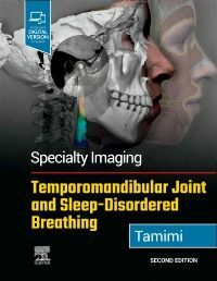 Specialty Imaging: Temporomandibular Joint and Sleep-Disordered Breathing (Hardcover, 2)