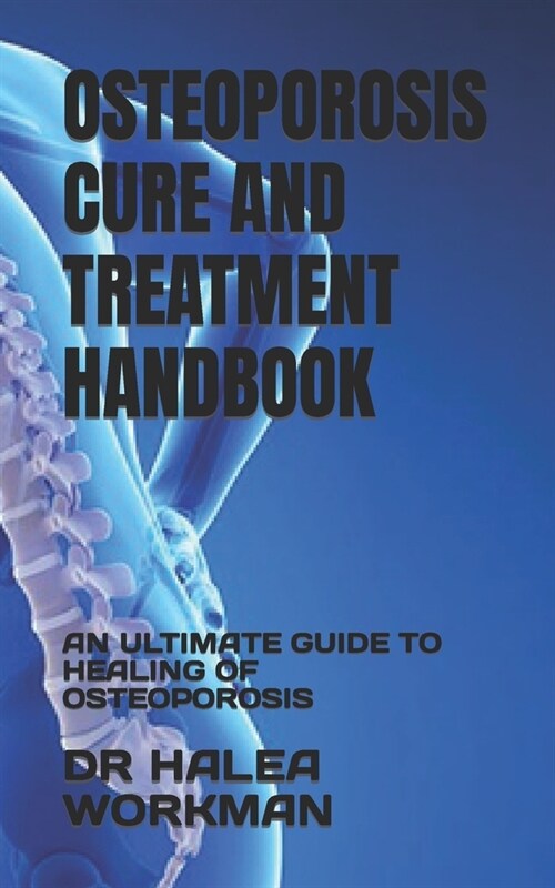 Osteoporosis Cure and Treatment Handbook: An Ultimate Guide to Healing of Osteoporosis (Paperback)