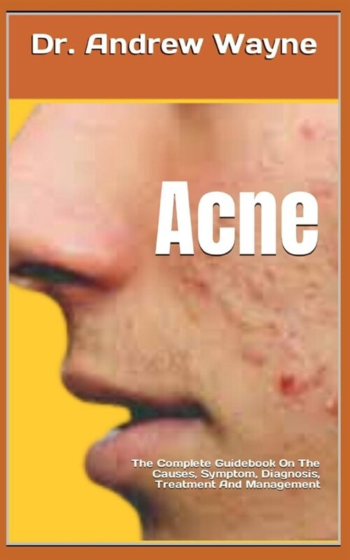 Acne: The Complete Guidebook On The Causes, Symptom, Diagnosis, Treatment And Management (Paperback)