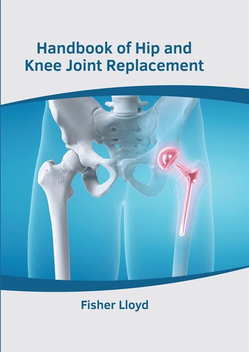 Handbook of Hip and Knee Joint Replacement (Hardcover)
