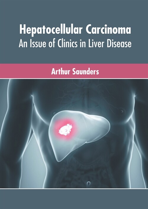 Hepatocellular Carcinoma: An Issue of Clinics in Liver Disease (Hardcover)