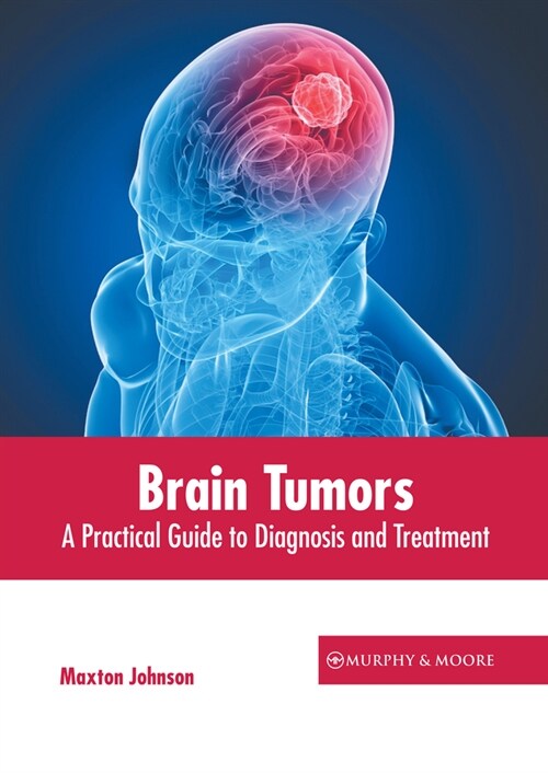 Brain Tumors: A Practical Guide to Diagnosis and Treatment (Hardcover)