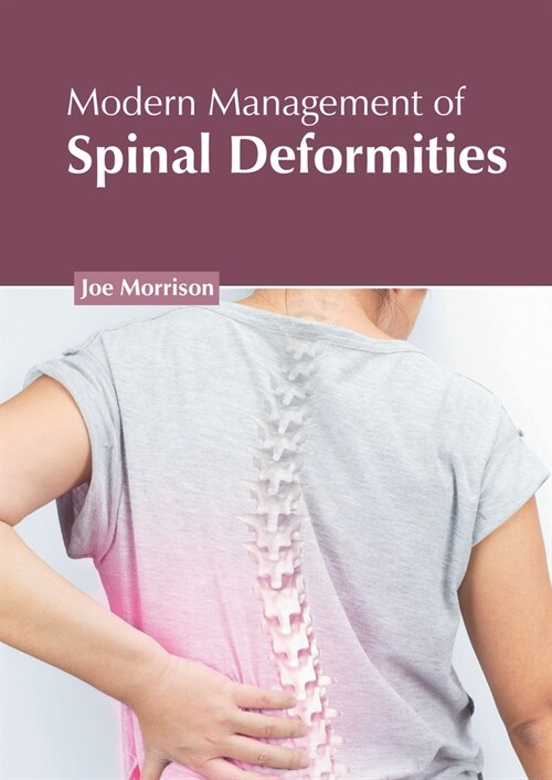 Modern Management of Spinal Deformities (Hardcover)