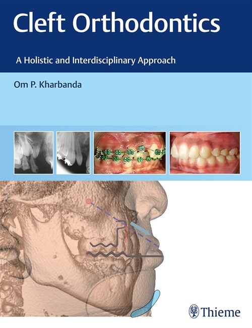 Cleft Orthodontics: A Holistic and Interdisciplinary Approach (Hardcover)