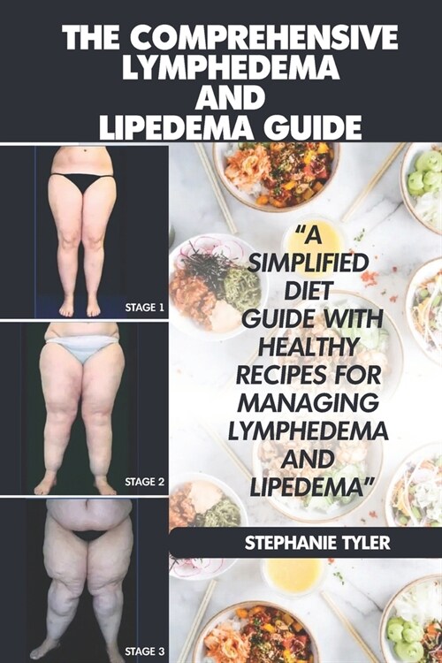 The Comprehensive Lymphedema and Lipedema Guide: The Comprehensive Lymphedema and Lipedema Guide (Paperback)