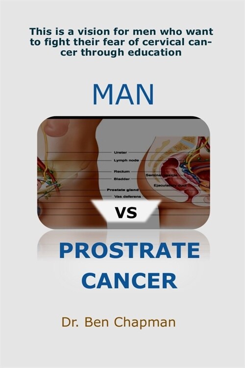 MAN Vs PROSTRATE CANCER: 100% Ageing Secret (Paperback)