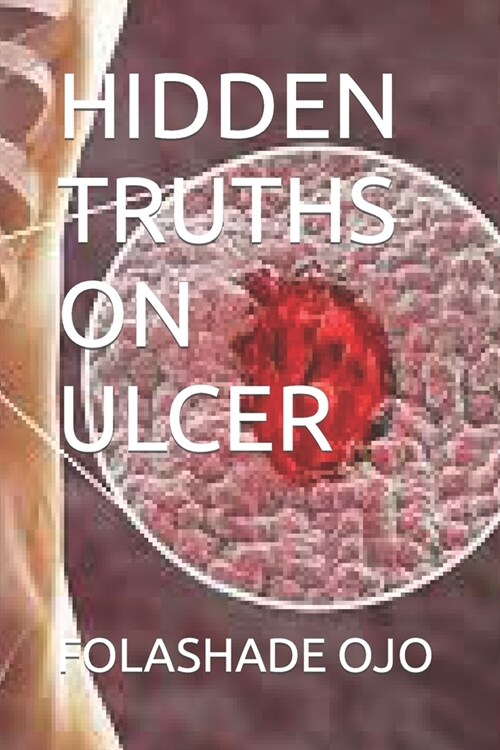 Hidden Truths on Ulcer (Paperback)