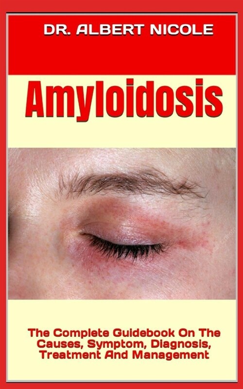 Amyloidosis: The Complete Guidebook On The Causes, Symptom, Diagnosis, Treatment And Management (Paperback)