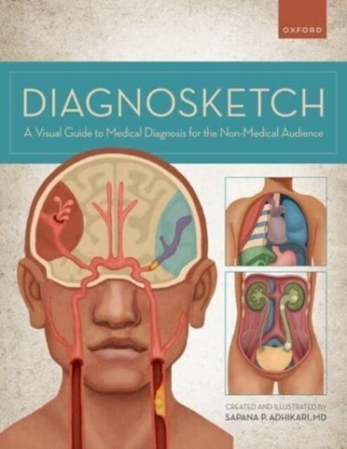 Diagnosketch: A Visual Guide to Medical Diagnosis for the Non-Medical Audience (Spiral)