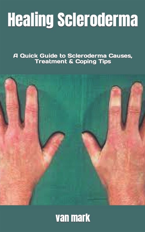 Healing Scleroderma: A Quick Guide to Scleroderma Causes, Treatment & Coping Tips (Paperback)