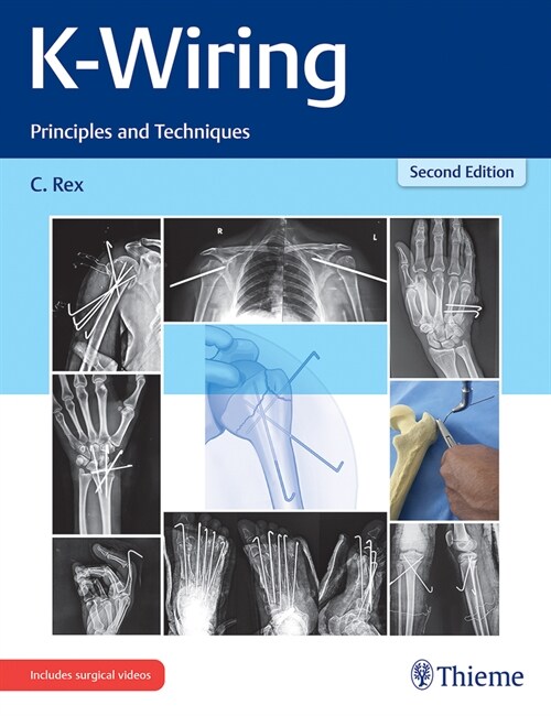 K-Wiring: Principles and Techniques (Hardcover, 2 ed)