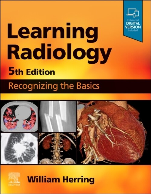 Learning Radiology: Recognizing the Basics (Paperback, 5)