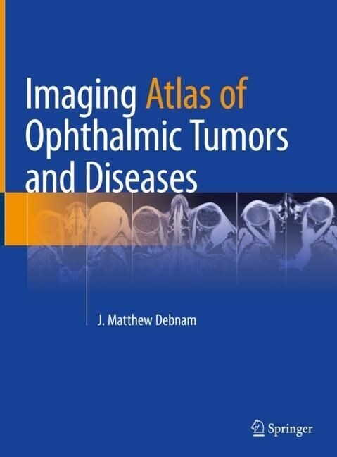 Imaging Atlas of Ophthalmic Tumors and Diseases (Hardcover)