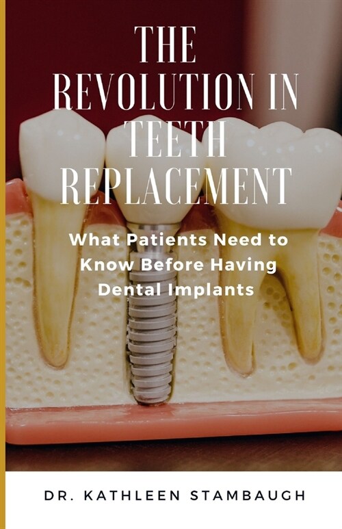 The Revolution in Teeth Replacement: What Patients Need to Know Before Having Dental Implants (Paperback)
