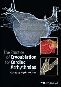 The Practice of Catheter Cryoablation for Cardiac Arrhythmias (Hardcover)