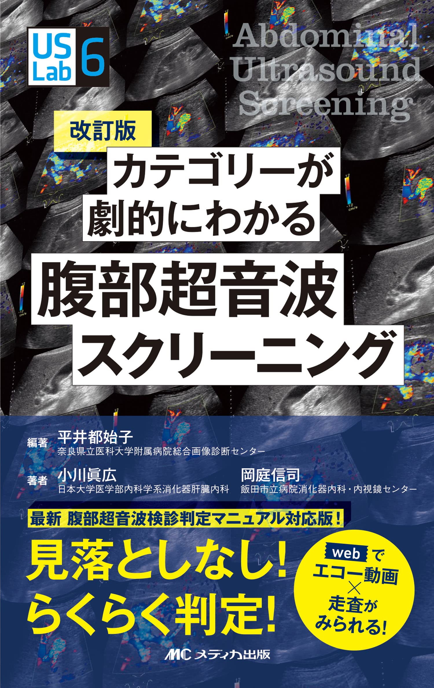 改訂版 カテゴリ-が劇的にわかる腹部超音波スクリ-ニング： webでエコ-動畵×走査がみられる！ (US Labシリ-ズ)