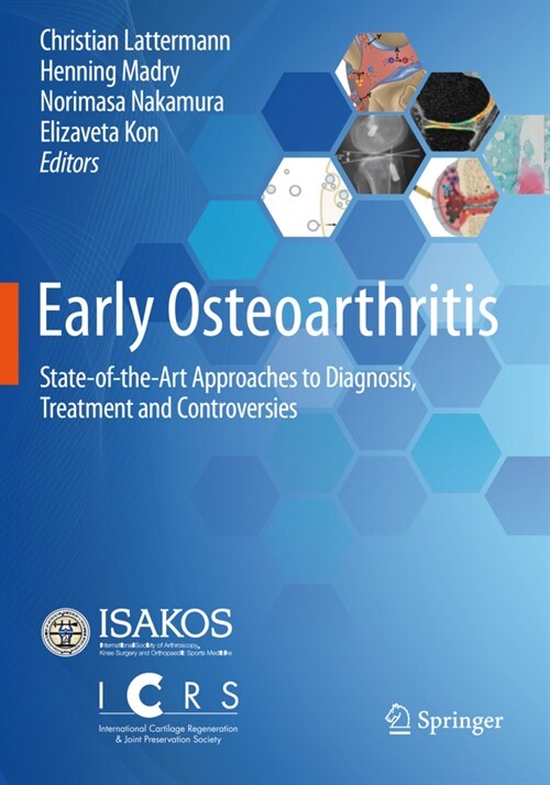 Early Osteoarthritis: State-Of-The-Art Approaches to Diagnosis, Treatment and Controversies (Paperback, 2022)