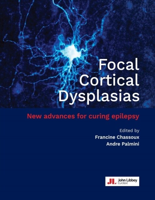 Focal Cortical Dysplasias : New advances for curing epilepsy (Hardcover)