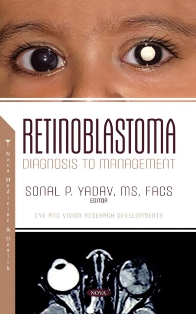 Retinoblastoma : Diagnosis to Management (Hardcover)