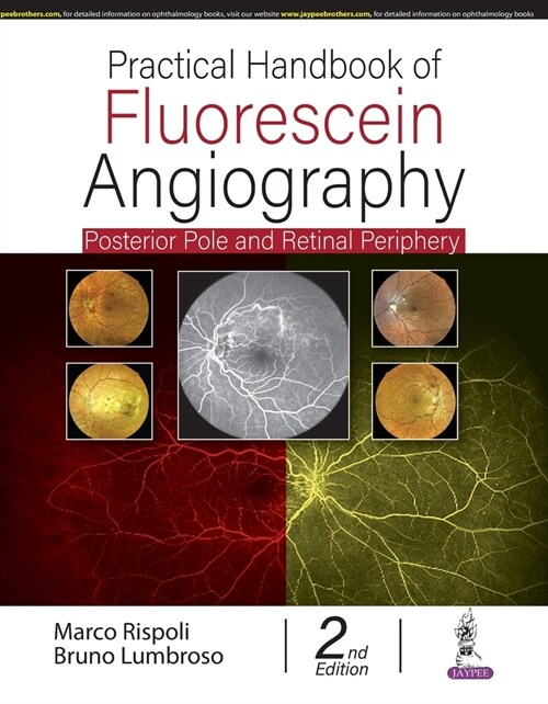 Practical Handbook of Fluorescein Angiography : Posterior Pole and Retinal Periphery (Hardcover, 2 Revised edition)