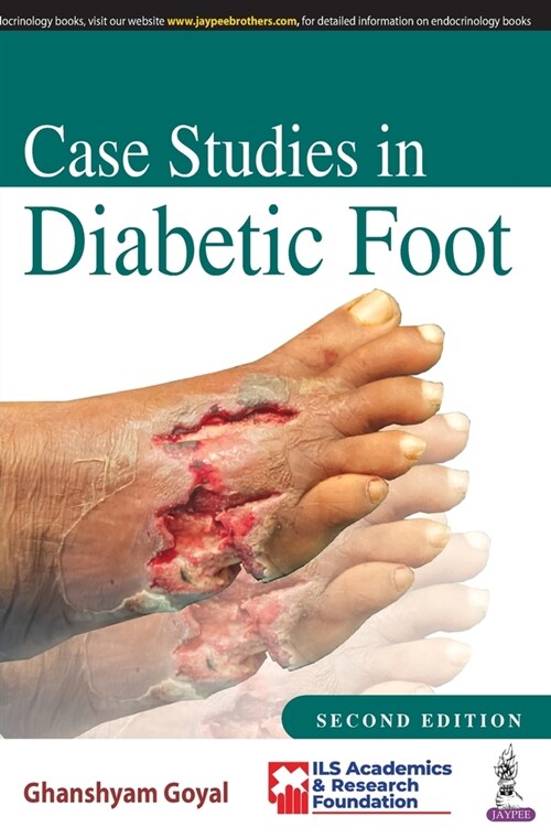 Case Studies in Diabetic Foot (Paperback, 2 Revised edition)
