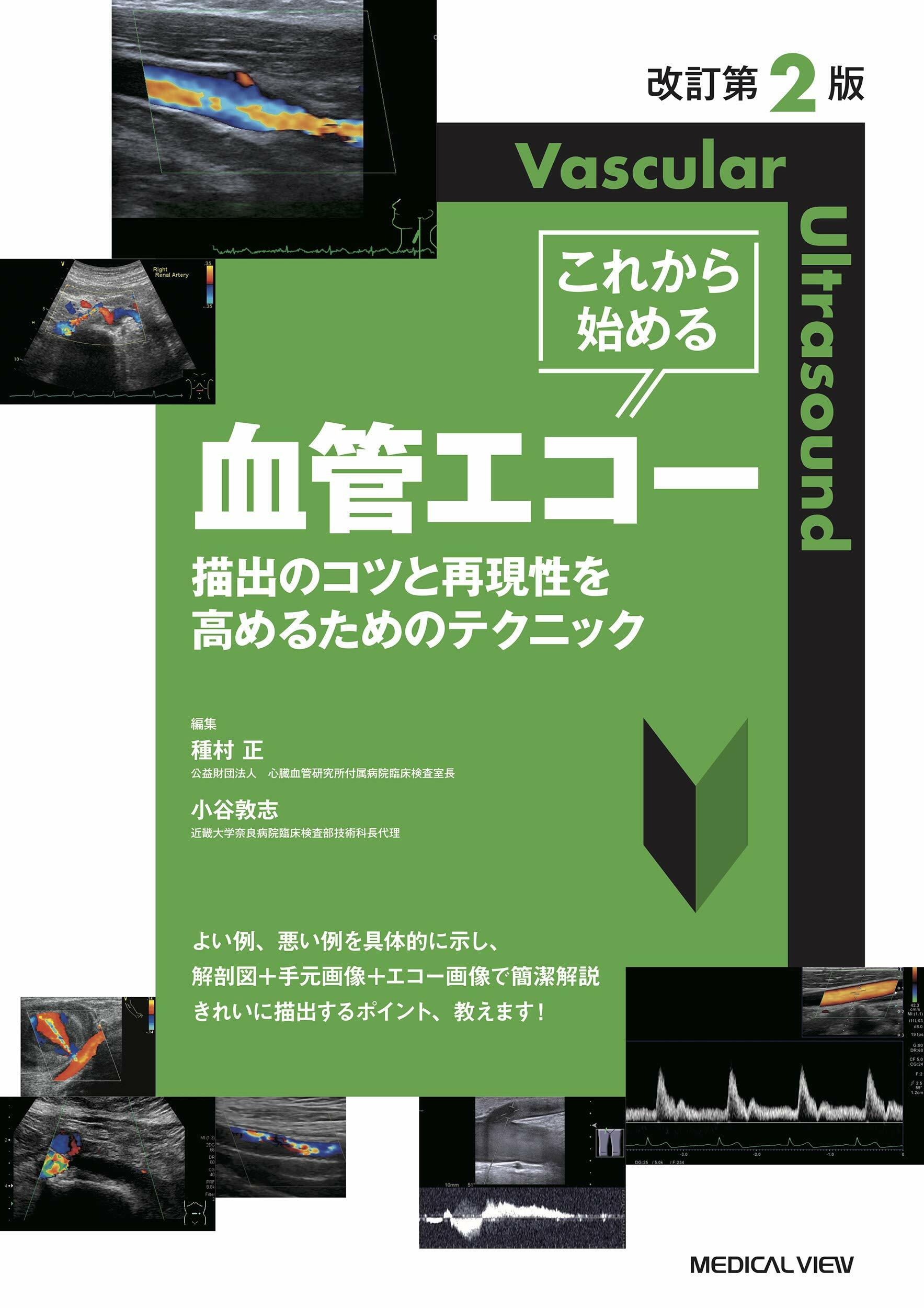 改訂第2版 これから始める血管エコ-