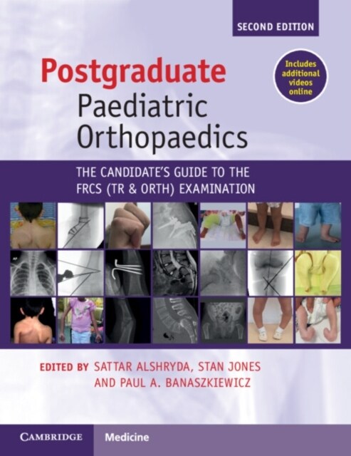 Postgraduate Paediatric Orthopaedics : The Candidates Guide to the FRCS(Tr&Orth) Examination (Paperback, 2 Revised edition)