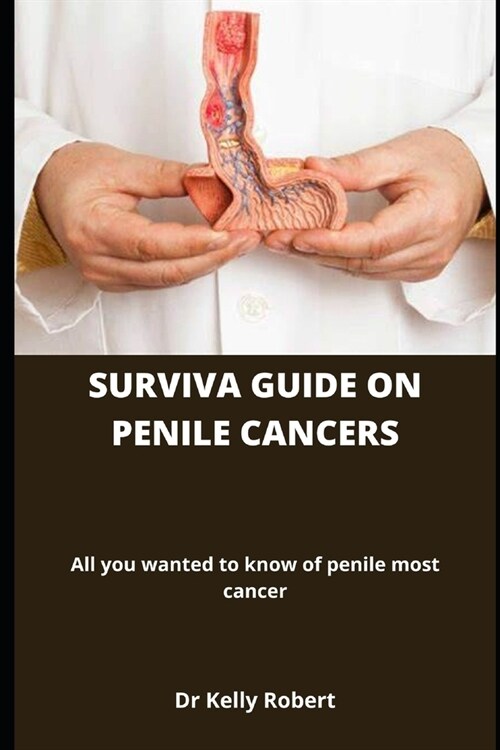 Surviva guide on penil most cancers: All you wanted to know of penile most cancer (Paperback)