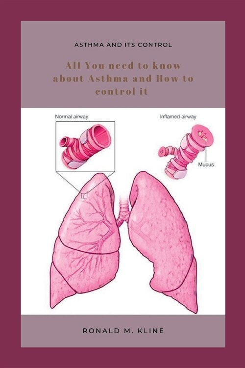 Asthma and its control: All you need to know about Asthma and how to control it. (Paperback)