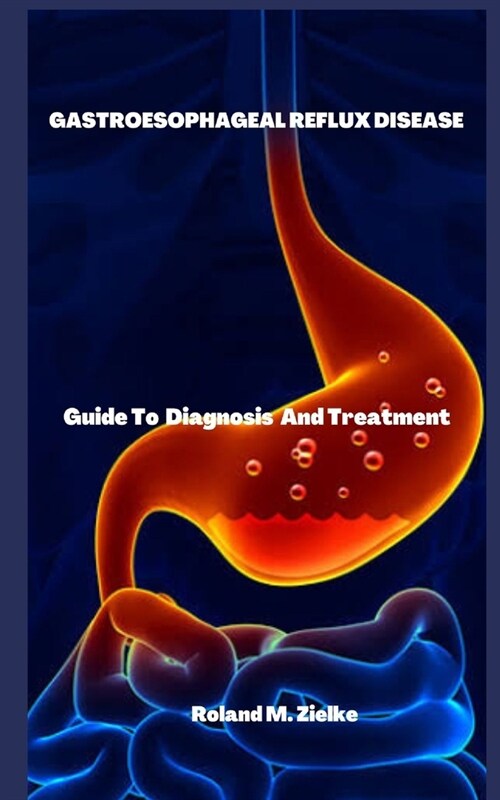 Gastroesophageal Reflux Disease: Guide To Diagnosis And Treatment (Paperback)