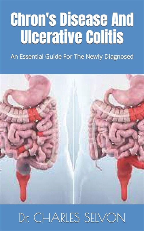 Chrons Disease And Ulcerative Colitis: An Essential Guide For The Newly Diagnosed (Paperback)