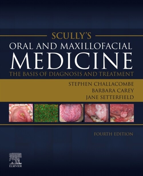 Scullys Oral and Maxillofacial Medicine: The Basis of Diagnosis and Treatment : The Basis of Diagnosis and Treatment (Paperback, 4 ed)