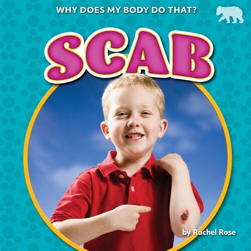 Scab (Paperback)