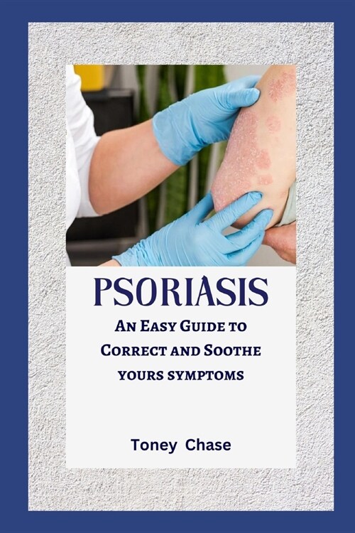 Psoriasis: An Easy Guide to Correct and Soothe yours symptoms (Paperback)