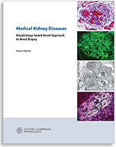 Medical Kidney Diseases: Morphology-Based Novel Approach To Renal Biopsy (Paperback  )