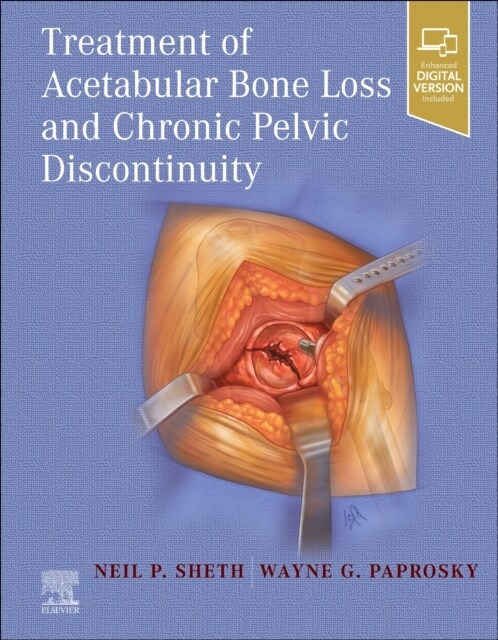 Treatment of Acetabular Bone Loss and Chronic Pelvic Discontinuity (Hardcover)