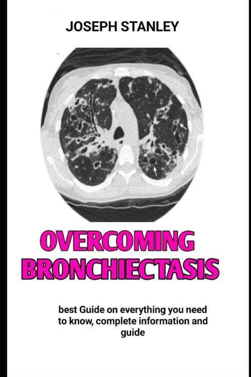Overcoming Bronchiectasis: The CLEAR Method to Living with Bronchiectasis (Paperback)